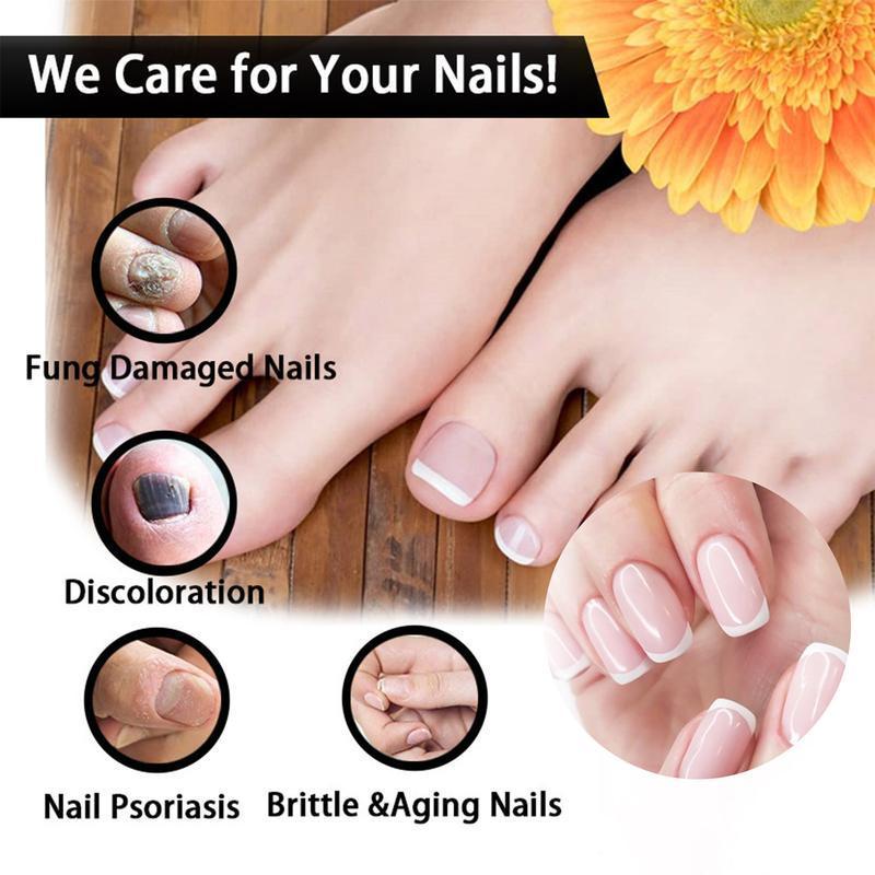 [Free shipping]EELHOE Nail Repair Solution Thickening BrightNails Removes Onychomycosis and Dead SkinRepairs Moisturizing Nail Art Nutritional CareSolution