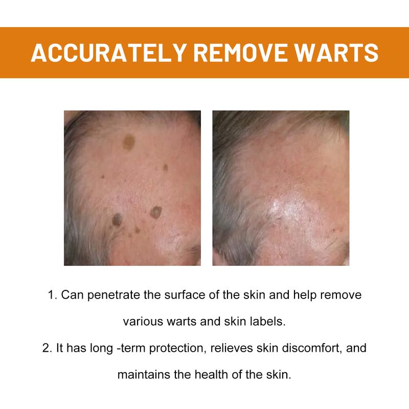 Wart Care Spray Skin Cleaning Repair Fade Moles Corns Body Care spray