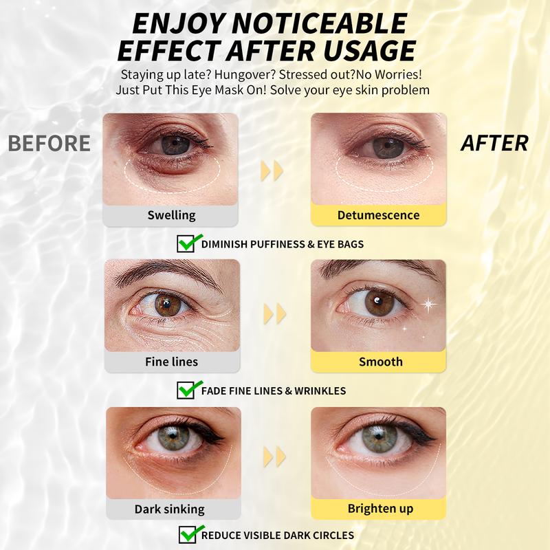 [Hot] MASKISS Under Eye Patches - Eye Mask for Dark Circles, Puffiness Daily Eye Care Smooth