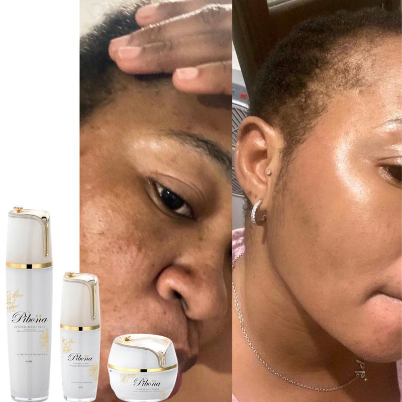 Flawless Set: Face Wash, Face Cream & Dark Spot Serum Remover - Hydrating Moisture