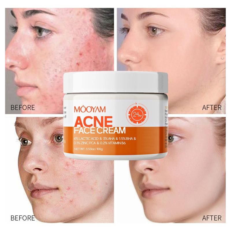 Acne Scar Treatment Cream 100ml Centella & Snail Repair Cream Post-Acne Marks Removal Acne&Pimple Treatment Fragrance Free Paraben Free Skincare Salicylic Skin Repair Sensitive Teens Crema para espinillas Cute skincare products