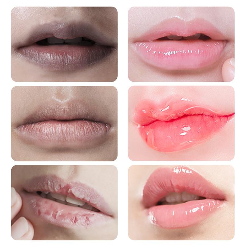 Fast Lightening Pink Mouth Lips Serum Bleaching Permanent Pinkish Moisturizing Lighten Dark Lip Balm Gloss Lipstick Lip Mask13ML