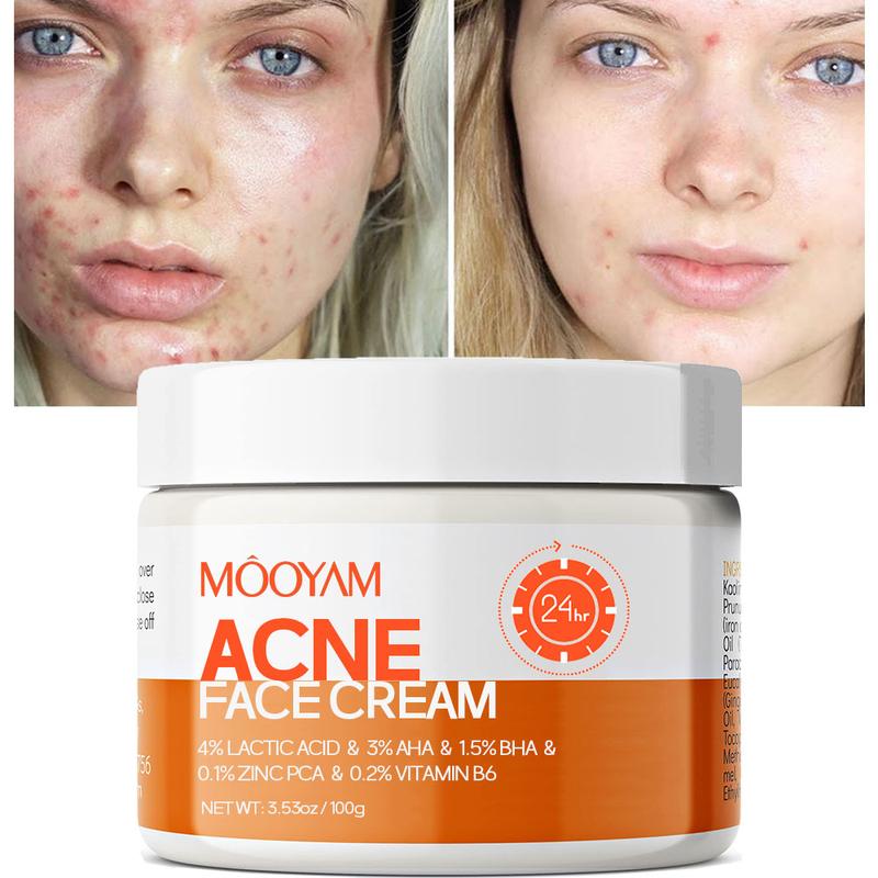 Acne Scar Treatment Cream 100ml Centella & Snail Repair Cream Post-Acne Marks Removal Acne&Pimple Treatment Fragrance Free Paraben Free Skincare Salicylic Skin Repair Sensitive Teens Crema para espinillas Cute skincare products