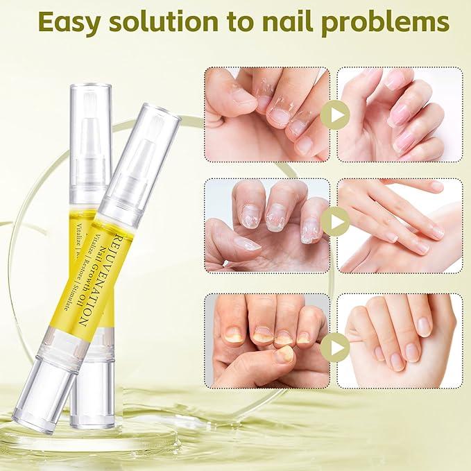 Rejuvenation Nail Growth Oil, Brother Cosmetics Nail Growth Oil, Nail Oil for Growth and Strength Rejuvenation, Rejuvenation Nail Growth Serum for Nail Strengthener and Growth with Nail File (4PCS)