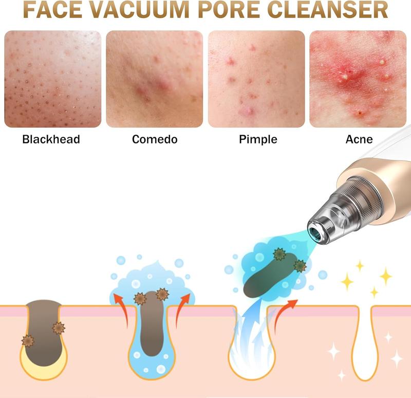 Blackhead Remover Vacuum-Black Head Remover for Face,Blackhead Extractor Tool with 3 Adjustable Suction Levels,5 Probes Pore Facial  christmas gift