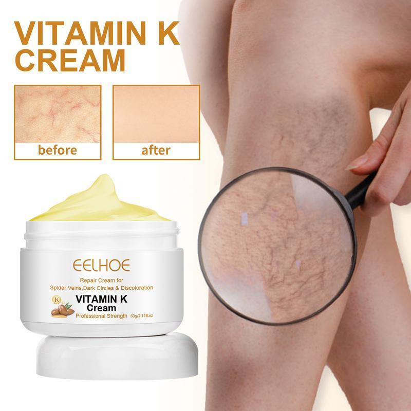 Leg Relief Varicose Veins Cream 60g for Pain and Swelling Body Care Lotions Comfort Skin Care