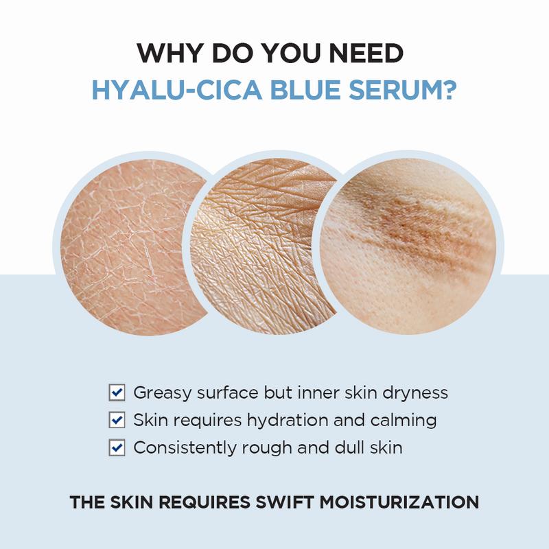 [SKIN1004 Official Shop] Hyalu-CICA Blue Serum 1.69 fl.oz, 50ml, 5 Layer Hyaluronic Acid Cica Niacinamide, Hydrating and Refreshing Multi-Care Solutions Moisture Skincare