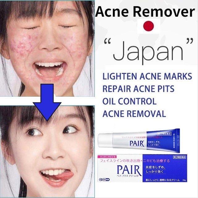 Lion Pair Acne Cream 14g Acne Treatment Pimples Removal Cream Pair Acne Creamy Foam Facial Wash