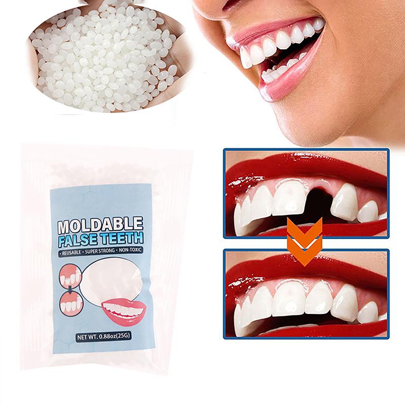 Resin 25g Temporary Tooth Repair Kit Teeth And Gaps False Teeth Solid Glue Denture Adhesive Teeth Whitening Tooth Beauty