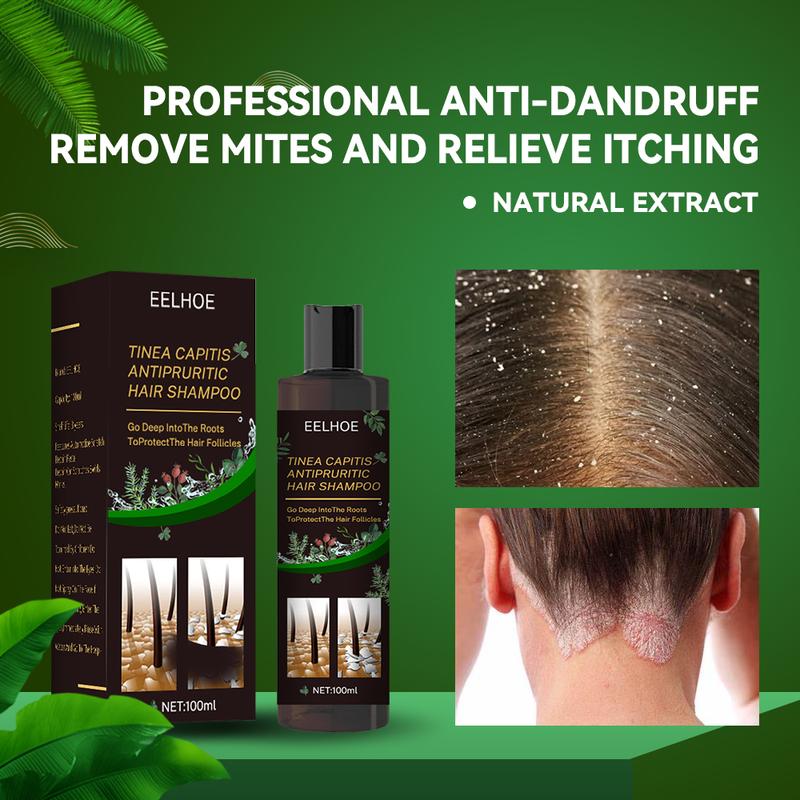 Scalp Ringworm Anti-itch Shampoo Anti-drop Refreshing Oil Control Hair Care Anti-dandruff Anti-itch Shampoo Deep into The Hair Root Protection Hair Follicle Anti-dandruff Anti-mite Anti-itch Prevent Dandruff Recurrence Conditioner Hair care