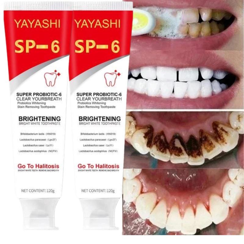 [Free Shipping] 2024 SP-6 Probiotic Toothpaste：Enhanced Formula Balances The Oral Microbiome, Removes Stains, And Provides Long-lasting Fresh Breath