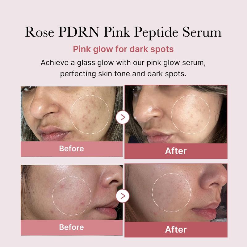 medicube PDRN Pink Peptide Serum, Pink glow serum, Peptide, Niacinamide, Hydrating & Moisturizing & Firming, Uneven Skin Tone, Korean Skincare | 1.01 fl.oz. (1.01 fl.oz., Rose PDRN (Vegan))