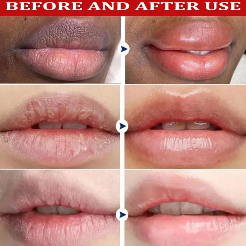 Remove Dark Lip Balm Exfoliating Dead Skin Fade Lip Line Lighten Melanin Lip Mask  Moisturizing Brighten Repair Lip Care Product