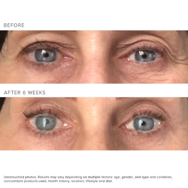 Rodan and Fields Redefine Multi-Function Anti-Aging Eye Cream eye cream retinol eye