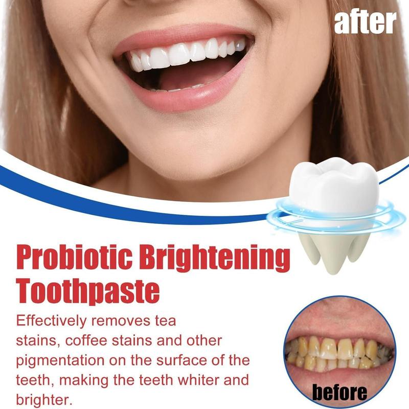 [+5$Get 2Pcs] Sp-6 Ultra Whitening,Sp 6 Toothpaste, Ultra Whitening Toothpaste Sp-6,Probiotic Brightening Toothpaste,Deep Cleaning Care Toothpaste,Fresh Breath Toothpaste