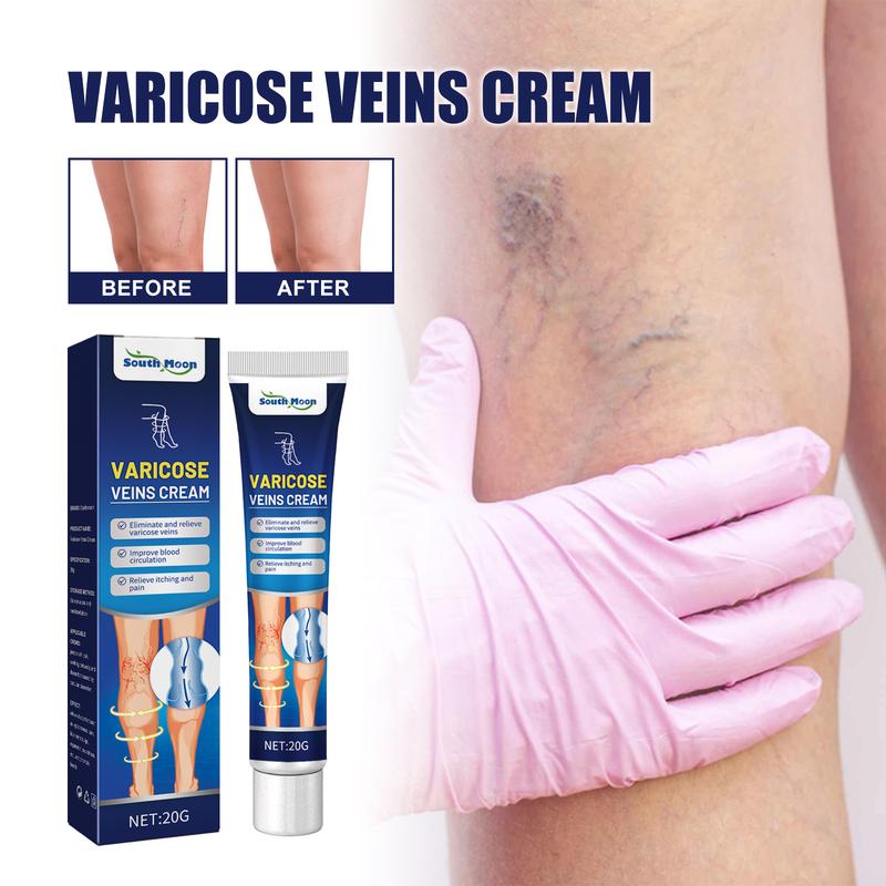 South Moon Vein Massage Varicose Cream Repair earthworm legs to relieve leg blood vessel bulge and varicoidea