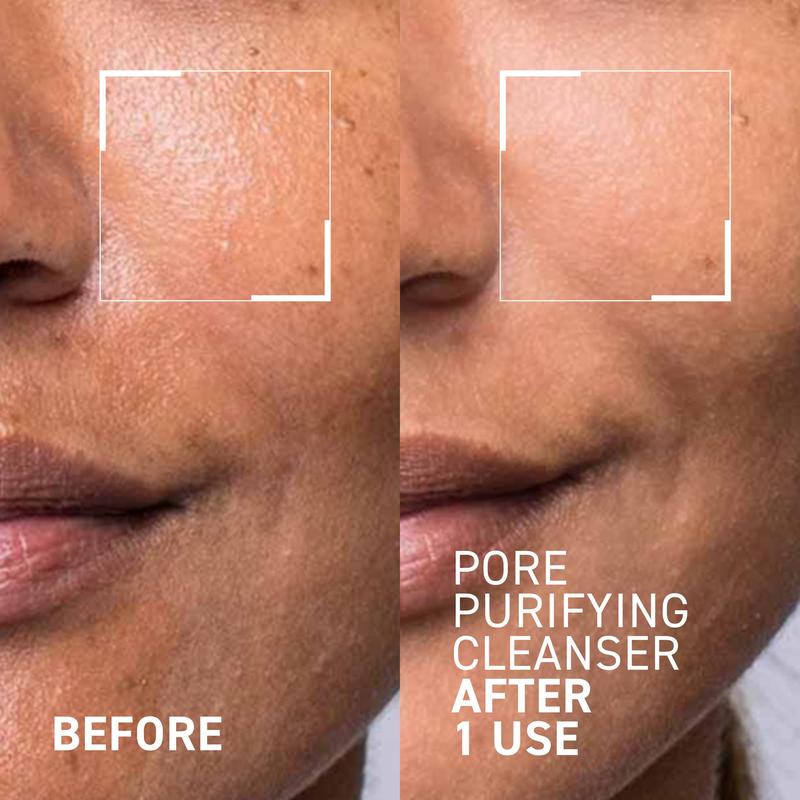 PORE PURIFYING CLEANSER with Salicylic Acid