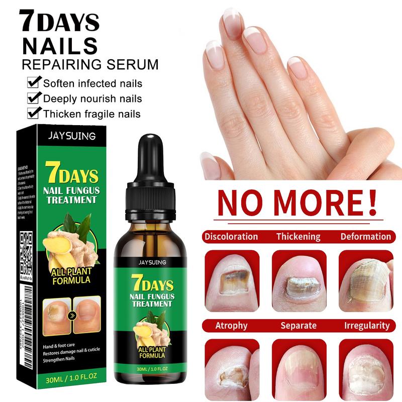 Ginger Nail Treatment Nail Support Nail Care Healthcare Nail Growth Oil For Strength and Moisture, Multi-Purpose Nail Repair, Nail Solution for Discolored and Damaged Nails, 1.0fl oz  Nail polish  JAYSUING 7 days