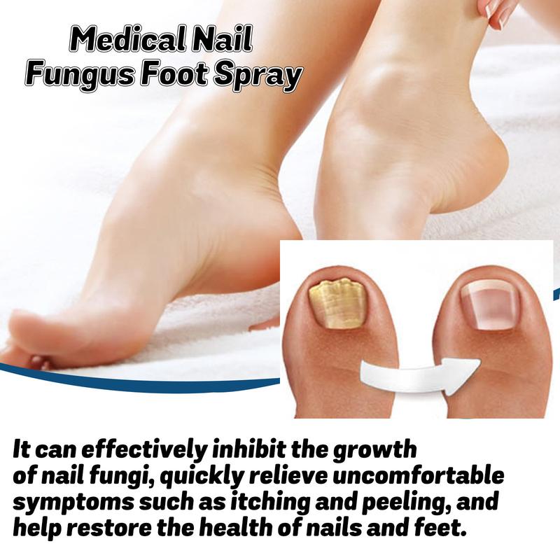 Nail Fungus Foot Spray Repair Thickened Gray Nails Rotten Nails Foot Moisturizing Clean Nail Care