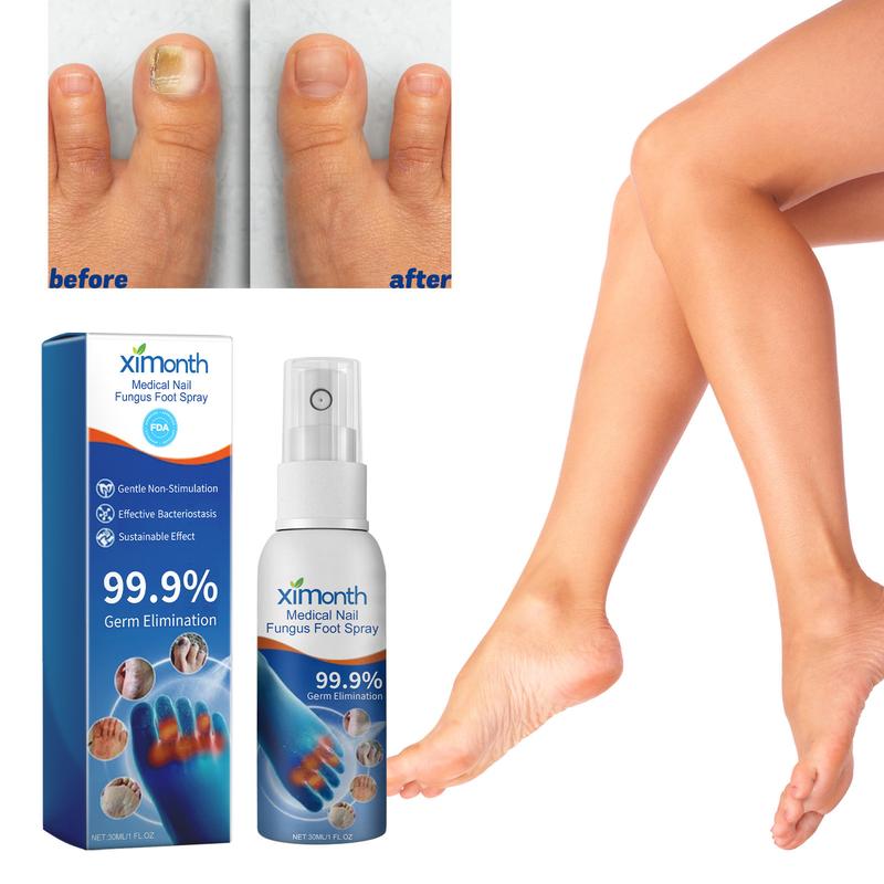 Nail Fungus Foot Spray Repair Thickened Gray Nails Rotten Nails Foot Moisturizing Clean Nail Care