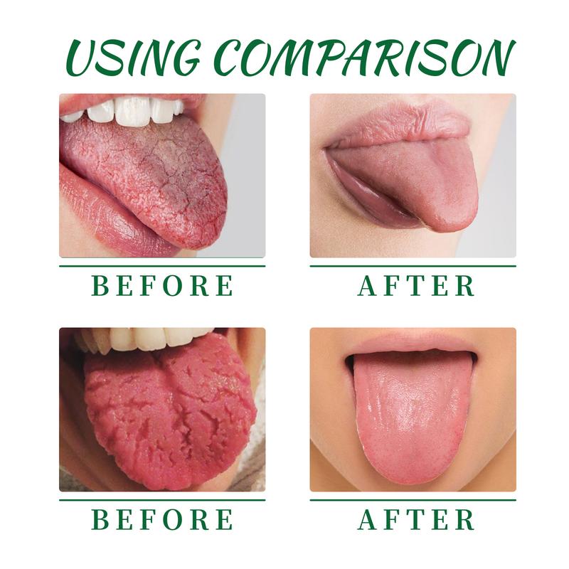 EELHOE tongue repair spray repairs white tongue coating relieves dry and swollen tongue oral care spray Portable to relieve pain, eliminate swelling, clean tongue repair spray, promote oral health