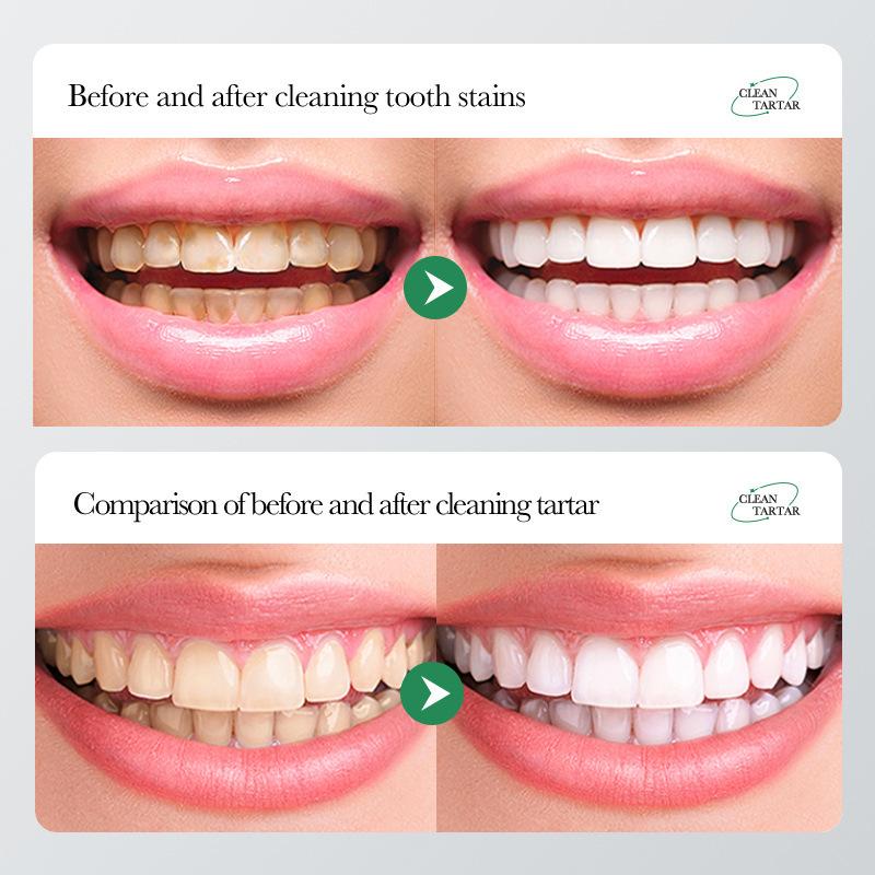 SP-7 PROBIOTIC WHITENING Toothpaste rich in many probiotics Effective Tooth Cleaning and Oral Health Management,Effect is better than SP-4 and SP-6