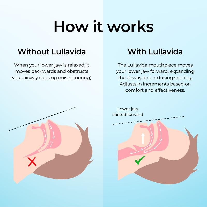 Lullavida Anti Snore Device - Anti Snoring Mouthpiece Product For Men - Adjustable Anti Snoring Device For Women