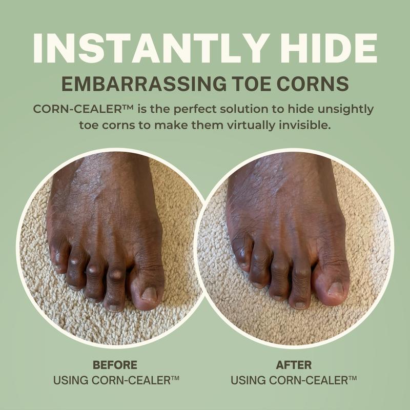 CORN-CEALER Is A Toe Makeup That Instantly Hides Toe Corns | Water Resistant | Foot Care | Body Makeup | Scar Makeup | Tattoo Cover up | Lightweight