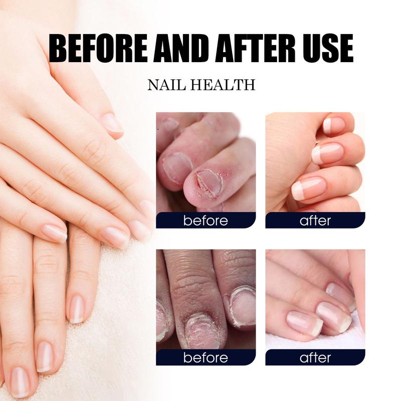 Tea Tree Oil for Nails Support Nail Care Manicure Antibacterial Daily Remedy Comfort