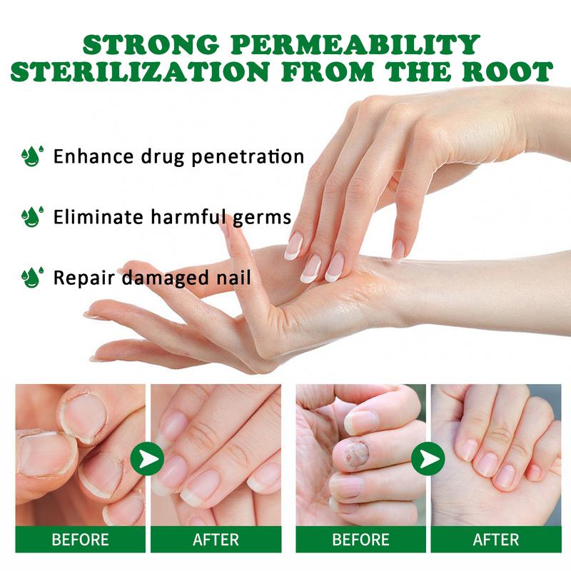 Ginger Nail Treatment Nail Care Healthcare Nail Repair Support Drop Nail Health Care Solution with Ginger extract Nail Growth Oil For Strength and Moisture Hongo Free Nail polish Comfort Moisturizer