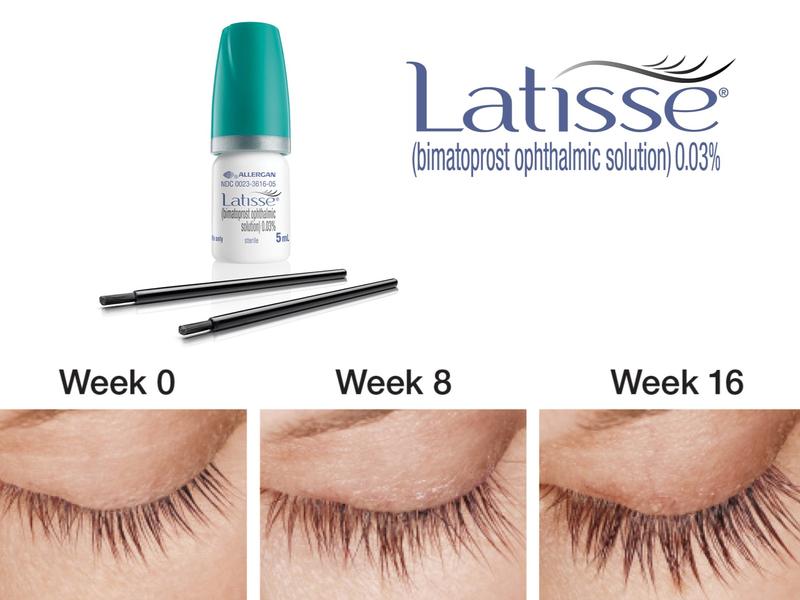 Latisse (Eyelash Growth Serum) Pack Kit for Fuller, Darker, Longer Fuller Eye Lashes 140 Applications